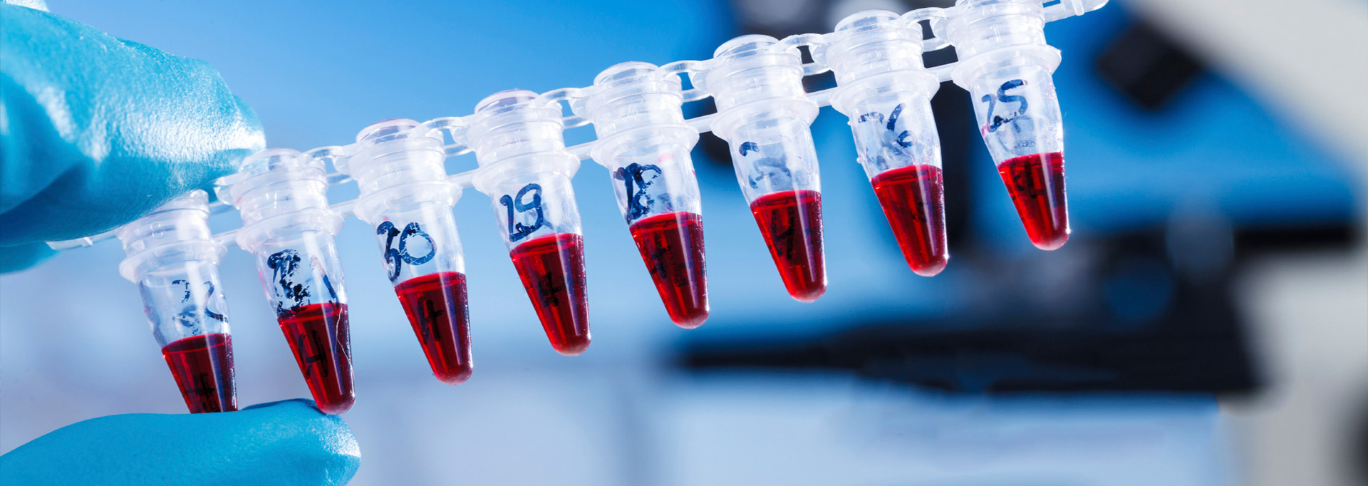 Vials in a Forensic Biology lab