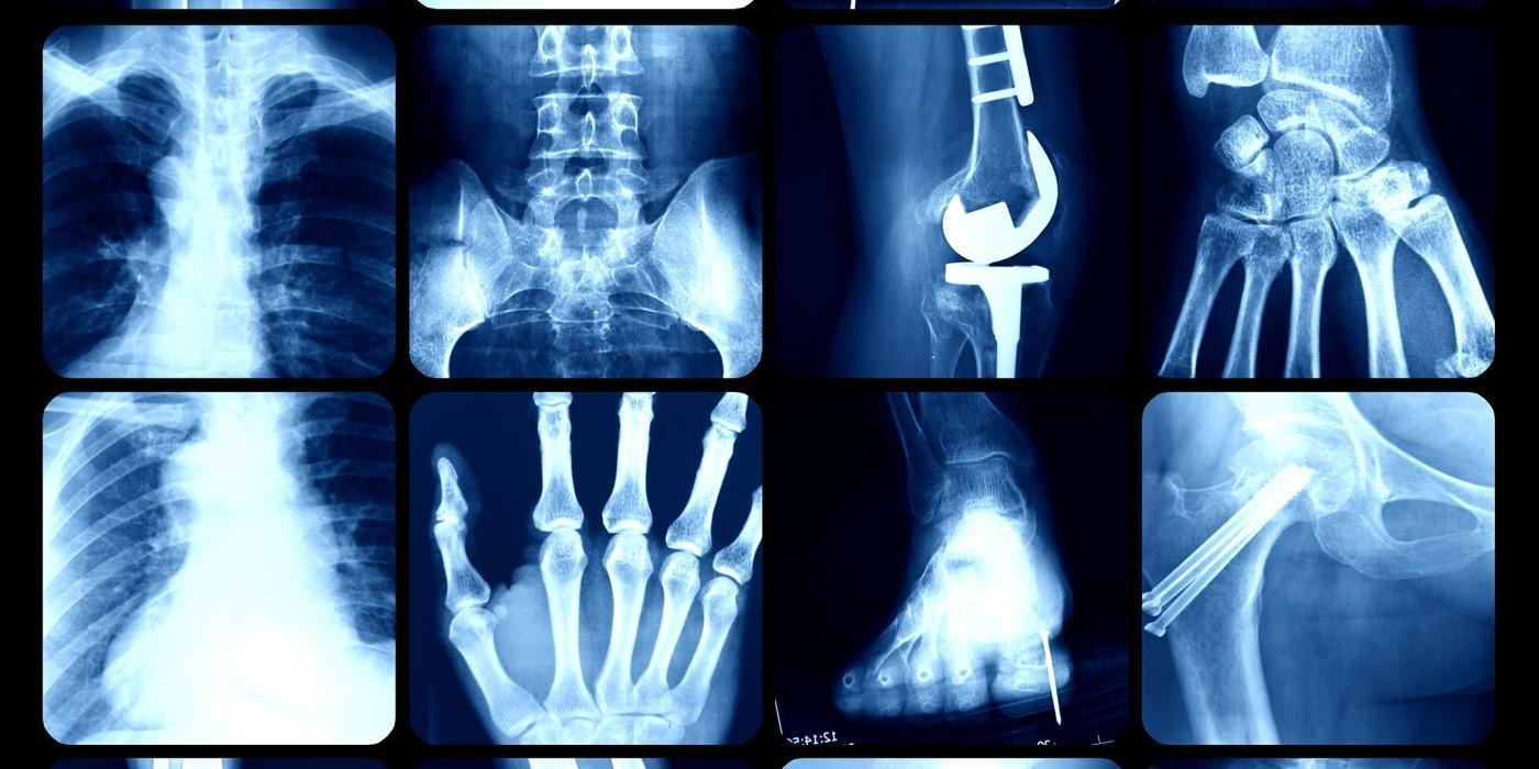 Medical X-rays displaying the spine, wrist, ankle, hip, and knee replacement, highlighting orthopaedic diagnostics, bone and joint disorders, surgical interventions, musculoskeletal rehabilitation, and advanced orthopaedic studies for an MSc Orthopaedics degree.