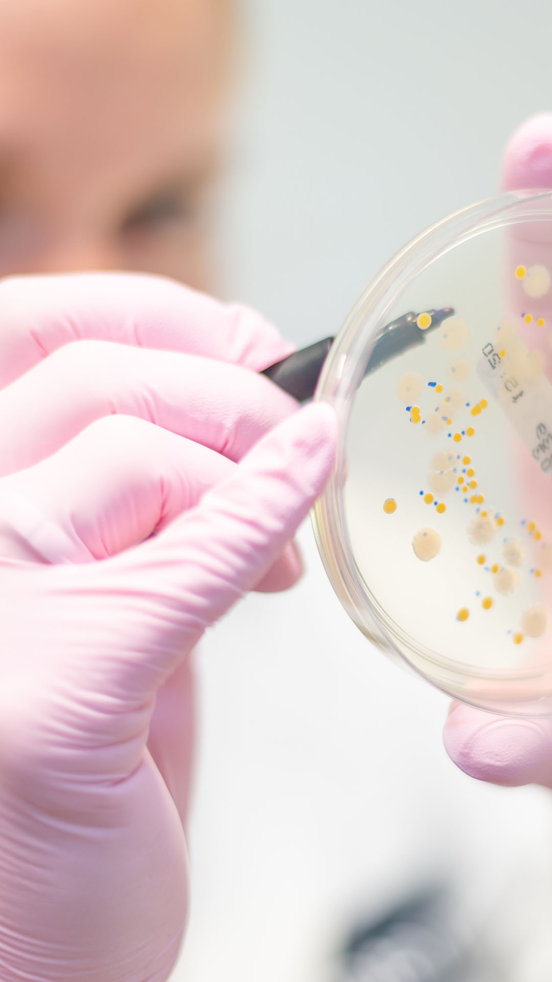 Laboratory employee counts bacteria colonies on an agar plate in a microbiology laboratory
