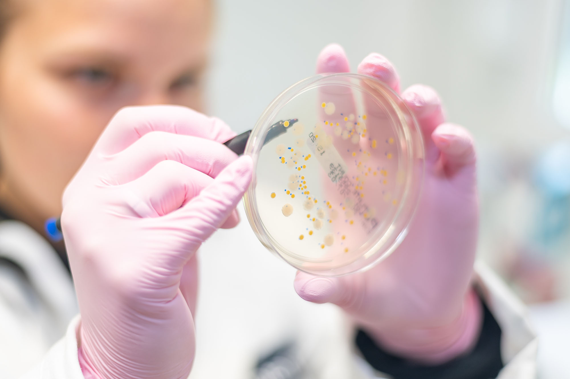 Laboratory employee counts bacteria colonies on an agar plate in a microbiology laboratory